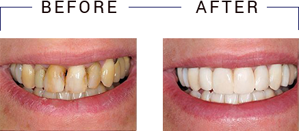 Cosmetic Dentist in Miami
