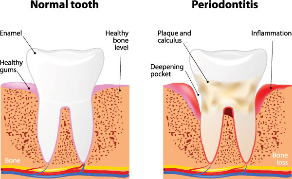 Rodlin Jerome, DDS | Periodontal Treatment, Digital Impressions and Dental Fillings